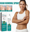 Medical Scar Removal Spray for Effective Skin Repair - Habibay Mart