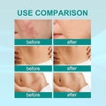 Medical Scar Removal Spray for Effective Skin Repair - Habibay Mart