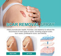 Medical Scar Removal Spray for Effective Skin Repair - Habibay Mart
