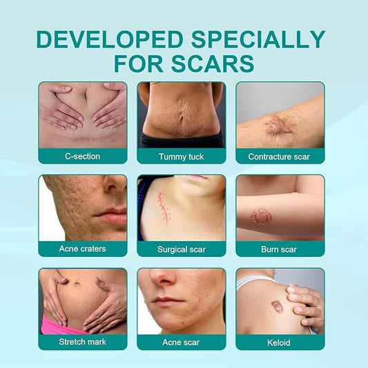 Medical Scar Removal Spray for Effective Skin Repair - Habibay Mart